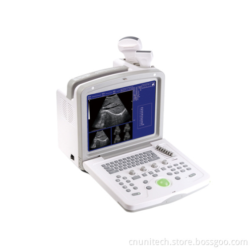Portable Ultrasound Scanner